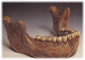 Kiefer Homo heidelbergensis